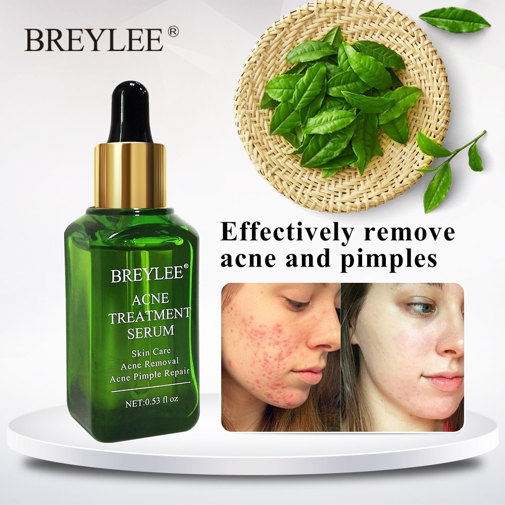 BREYLEE Acne Treatment Serum Face Facial Anti Acne Scar Removal Cream Skin Care Whitening Repair Pimple Remover For Acne BREYLEE Acne Treatment Serum Face Facial Anti Acne Scar Removal Cream Skin Care Whitening Repair Pimple Remover For Acne